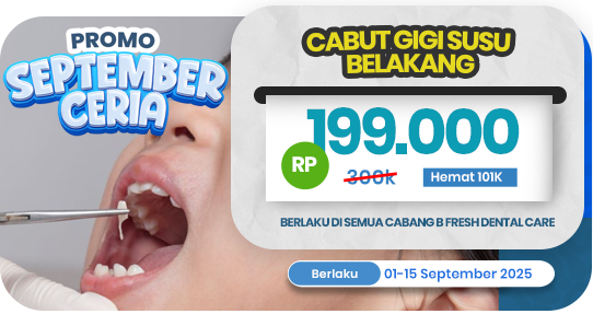 Cabut Gigi Susu Anak Belakang